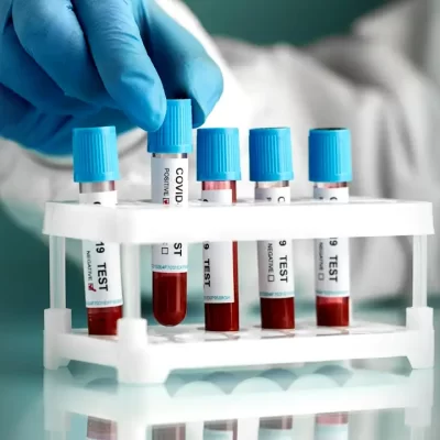 28 Blood Tests List What are they Definitions and Abbreviations How to Book Price in India